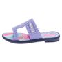 Sandalia-Infantil-Minnie-Grendene-Kids-22491-3290491E_055-02